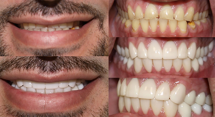 Dentist Waukesha WI Hillcrest Family Dental Smile Gallery 18