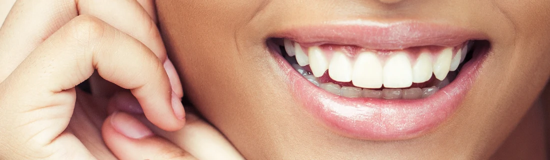 Dentist Waukesha WI Smiling Woman Veneers